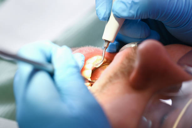 Best Emergency Gum Treatment in Banner Hill, TN